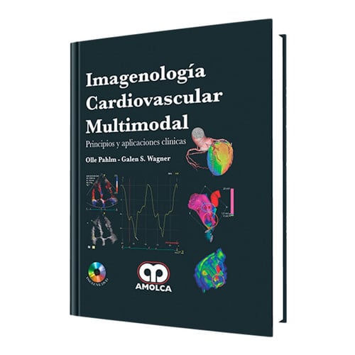 PAHLM IMAGENOLOGIA CARDIOVASCULAR MULTIMODAL PRINCIPIOS Y, de OLLE PAHLM | portada del libro