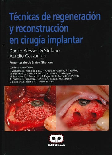 TECNICAS DE REGENERACION Y RECONSTRUCCION EN CIRUGIA IMPLANTAR | portada del libro
