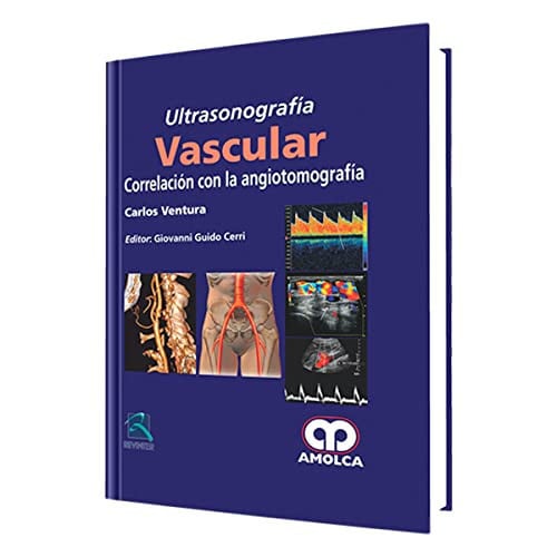 VENTURA ULTRASONOGRAFIA VASCULAR CORRELACION CON LA ANGIOT | portada del libro