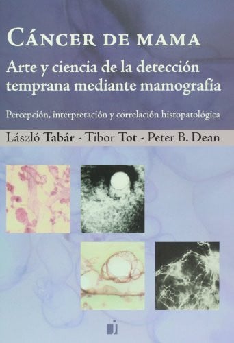 CANCER DE MAMA ARTE Y CIENCIA DE LA DETECCION TEMPRANA MEDIA, de L. TABAR | portada del libro