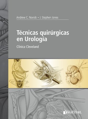 TECNICAS QUIRURGICAS EN UROLOGIA CLINICA CLEVELAND, de NOVICK | portada del libro