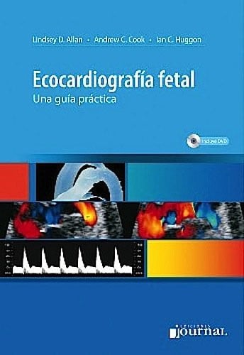 ECOCARDIOGRAFIA FETAL UNA GUIA PRACTICA, de ALLAN | portada del libro
