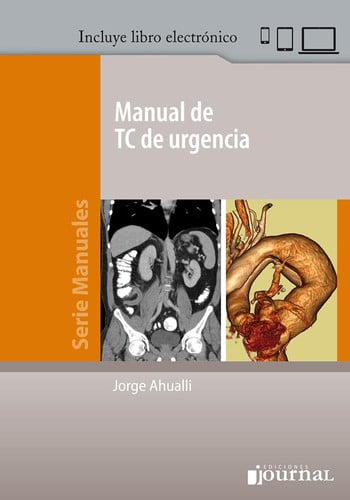 MANUAL DE TC DE URGENCIA, de AHUALLI | portada del libro