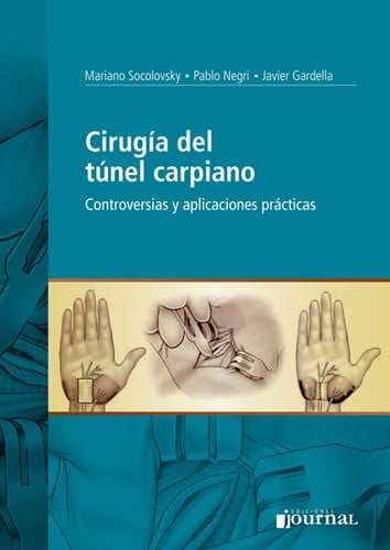 CIRUGIA DEL TUNEL CARPIANO CONTROVERSIAS Y APLICACIONES PRAC, de MARIANO SOCOLOVSKY | portada del libro