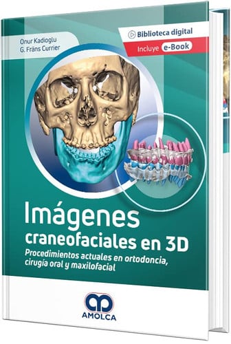 KADIOGLU IMAGENES CRANEOFACIALES EN 3D PROCEDIMIENTOS ACT, de E. KADIOGLU | portada del libro