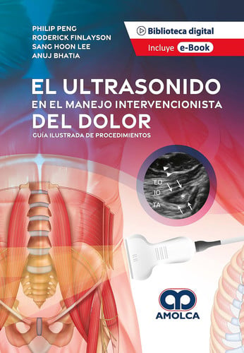 PENG EL ULTRASONIDO EN EL MANEJO INTERVENCIONISTA DEL DOLOR | portada del libro