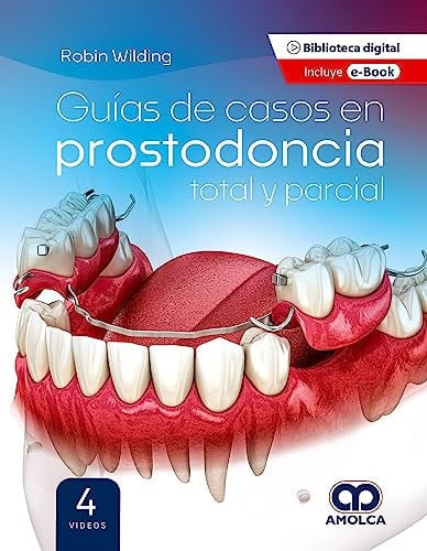 WILDING GUIAS DE CASOS EN PROSTODONCIA TOTAL Y PARCIAL, de ROBIN WILDING | portada del libro