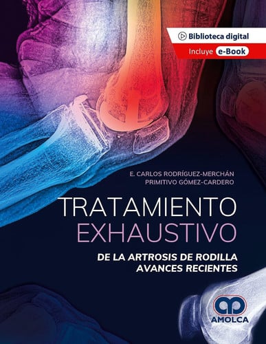 RODRIGUEZ TRATAMIENTO EXHAUSTIVO DE LA ARTROSIS DE RODILLA, de B. MERCHAN RODRIGUEZ | portada del libro
