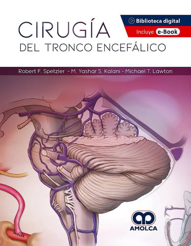 SPETZLER CIRUGIA DEL TRONCO ENCEFALICO, de SPETZLER | portada del libro