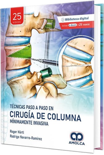 TECNICAS PASO A PASO EN CIRUGIA DE COLUMNA MINIMAMENTE INVA, de HARTL | portada del libro