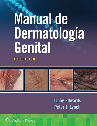 MANUAL DE DERMATOLOGIA GENITAL, de EDWARDS | portada del libro