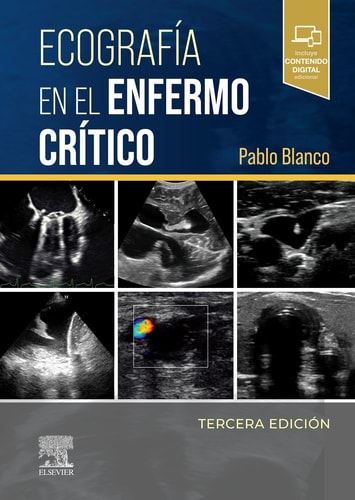ECOGRAFIA EN EL ENFERMO CRITICO, de BLANCO | portada del libro