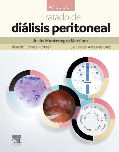 TRATADO DE DIALISIS PERITONEAL 4 ED, de Jesús Montenegro Martínez | portada del libro