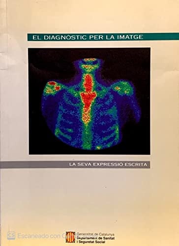 DIAGNOSTIC PER LA IMATGE, EL, de CASASSAS | portada del libro