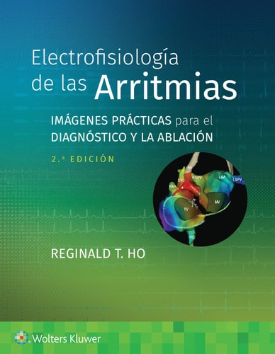 ELECTROFISIOLOGIA DE LAS ARRITMIAS., de VV.AA. | portada del libro