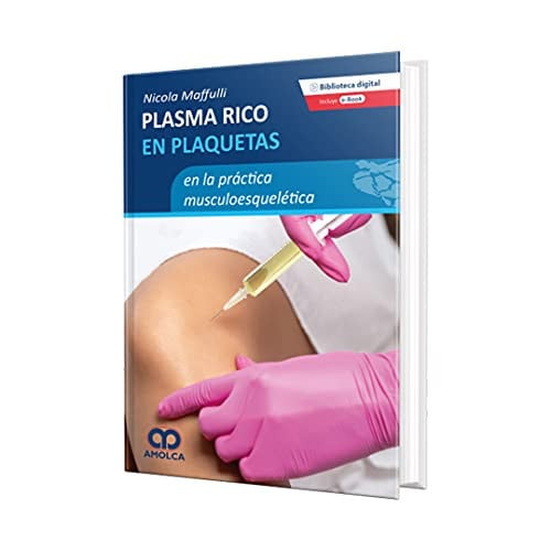 PLASMA RICO EN PLAQUETAS EN LA PRACTICA MUSCULOESQUELETICA, de MAFULLI | portada del libro