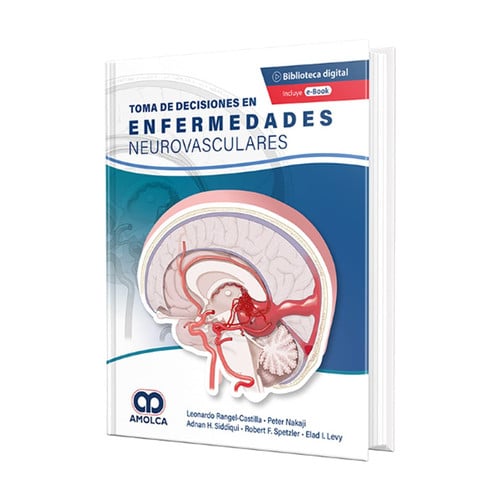 Toma de Decisiones en Enfermedades Neurovasculares, de RANGEL CASTILLA | portada del libro