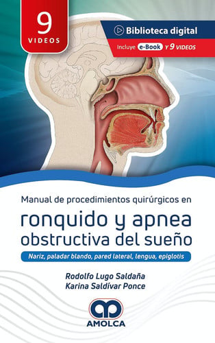 MANUAL DE PROCEDIMIENTOS QUIRURGICOS EN RONQUIDO Y APNEA OB, de LUGO | portada del libro