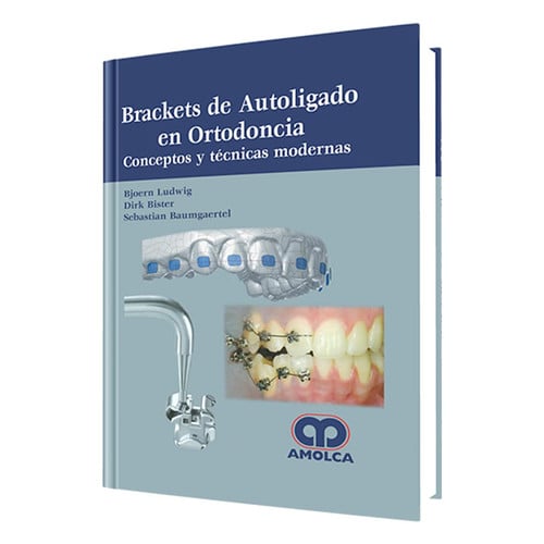 LUDWIG BRACKETS DE AUTOLIGADO EN ORTODONCIA | portada del libro