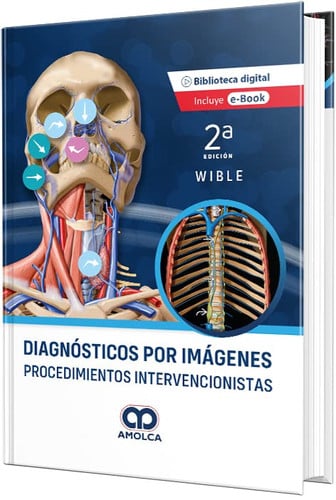 WIBLE DIAGNOSTICOS POR IMAGENES PROCEDIMIENTOS INTERVENCIO, de B. WIBLE | portada del libro
