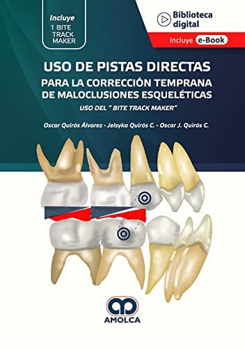 USO DE PISTAS DIRECTAS PARA LA CORRECCION TEMPRANA DE MALOC, de QUIROS | portada del libro