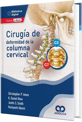 AMES CIRUGIA DE DEFORMIDAD DE LA COLUMNA CERVICAL, de Varios autores | portada del libro