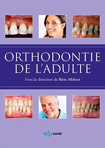ORTHODONTIE DE L'ADULTE, de Birte Melsen | portada del libro