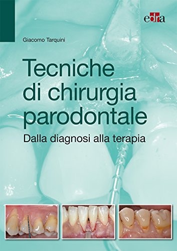 TECNICHE DI CHIRURGIA PARODONTALE, de Giacomo Tarquini | portada del libro