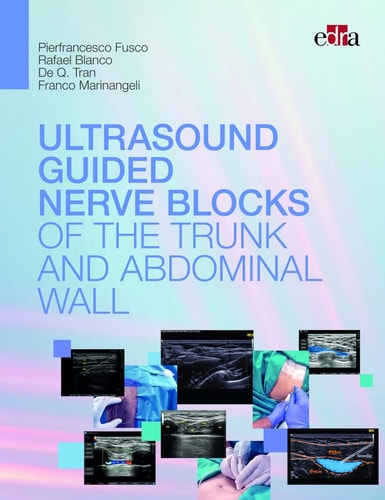 ULTRASOUND GUIDED NERVE BLOCKS OF THE TRUNK AND ABDOMINAL WA, de Pierfrancesco Fusco | portada del libro