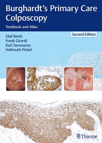 BURGHARDTS PRIMARY CARE COLPOSCOPY TEXTBOOK AND ATLAS, de REICH | portada del libro