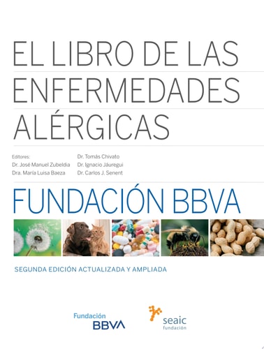 EL LIBRO DE LAS ENFERMEDADES ALERGICAS, de ZUBELDIA ORTUÑO | portada del libro