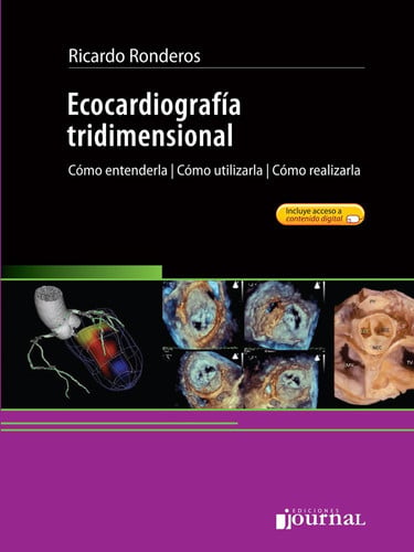 ECOCARDIOGRAFIA TRIDIMENSIONAL COMO ENTENDERLA COMO UTILIZAR, de RONDEROS | portada del libro