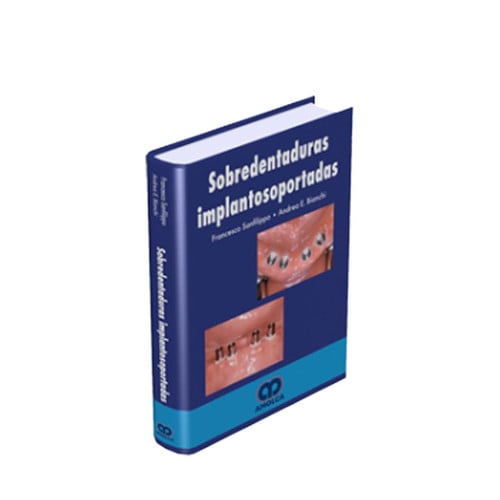 SANFILIPPO SOBREDENTADURAS IMPLANTOSOPORTADAS, de ANDREA BIANCHI | portada del libro