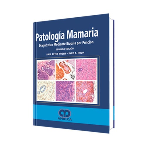 ROSEN PATOLOGIA MAMARIA DIAGNOSTICO MEDIANTE BIOPSIA POR P, de P. ROSEN | portada del libro