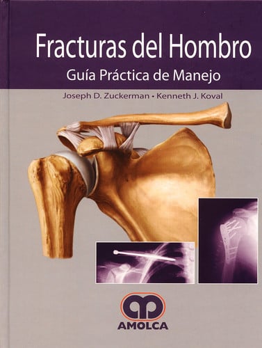 ZUCKERMAN FRACTURAS DEL HOMBRO GUIA PRACTICA DE MANEJO, de JOSEPH D. ZUCKERMAN | portada del libro