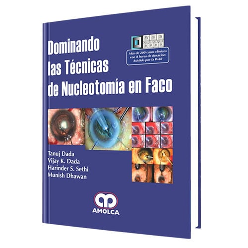 DADA DOMINANDO LAS TECNICAS DE NUCLEOTOMIA EN FACO, de T. DADA | portada del libro