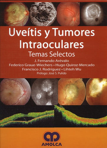AREVALO UVEITIS Y TUMORES INTRAOCULARES, de J. FERNANDO AREVALO | portada del libro