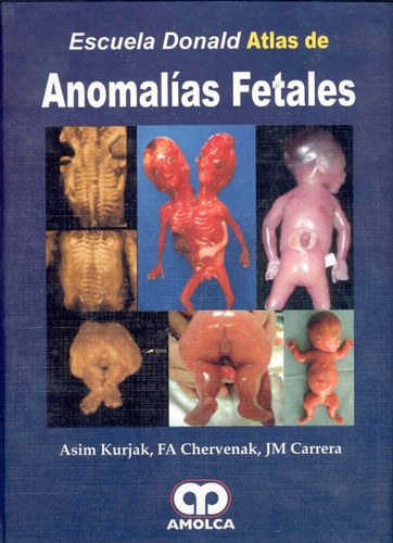 KURJAK ATLAS DE ANOMALIAS FETALES, de ASIM KURJAK | portada del libro