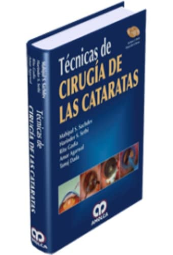 TECNICAS DE CIRUGIA DE LAS CATARATAS | portada del libro
