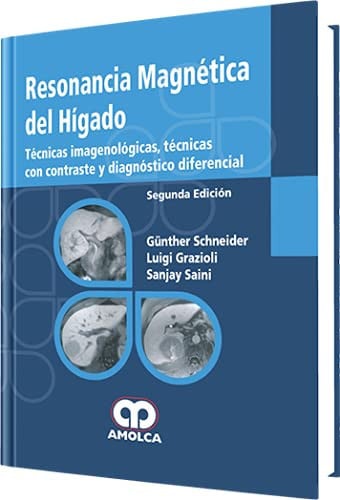 SCHNEIDER RESONANCIA MAGNETICA DEL HIGADO 2E | portada del libro