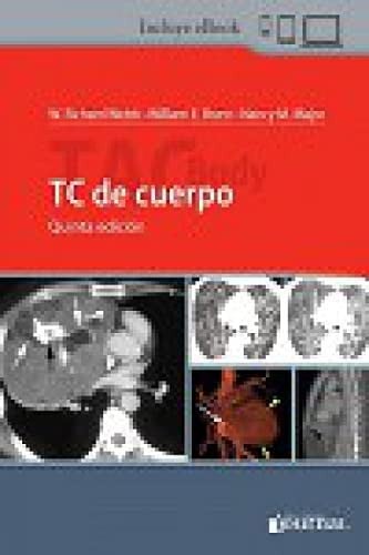 TC DE CUERPO (5ª EDICION), de WEBB | portada del libro