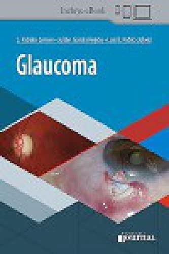 GLAUCOMA, de LERNER | portada del libro