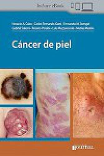 CANCER DE PIEL, de CABO | portada del libro