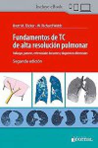 FUNDAMENTOS DE TC DE ALTA RESOLUCION PULMONAR HALLAZGOS, de ELICKER | portada del libro