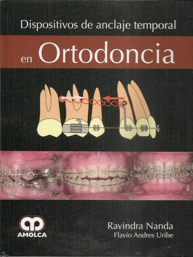 Dispositivos de anclaje temporal en ortodoncia | portada del libro