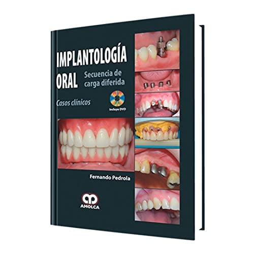 PEDROLA IMPLANTOLOGIA ORAL SECUENCIA DE CARGA DIFERIDA C | portada del libro