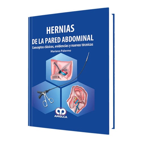 PALERMO HERNIAS DE LA PARED ABDOMINAL | portada del libro