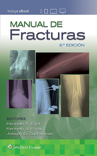 MANUAL DE FRACTURAS 6ºED, de EGOL | portada del libro