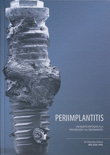 PERI IMPLANTITIS UN NUEVO ENFOQUE A LA PREVENCION Y SU TRAT, de Anitua Aldecoa | portada del libro