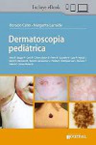 DERMATOSCOPIA PEDIATRICA, de CABO | portada del libro